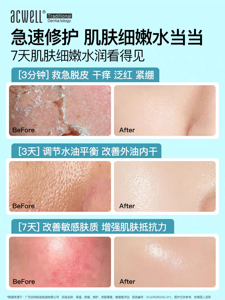 Aikewei N4 Hydrating Balance Lotion 140ml Hydrating, Moisturizing, Soothing and repairing sensitive skin care products Specification image