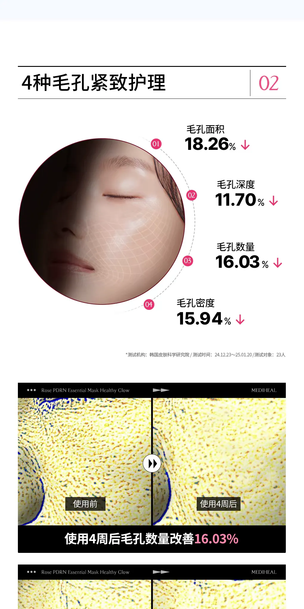 【 New Product 3.0 Upgrade 】 Korean imported Medilveil Rose Radiance Mask 10 pieces per box, Hydrating Essence Mask, Pore-improving Care Mask, Medilveil Rose Mask, original genuine product detail image 12
