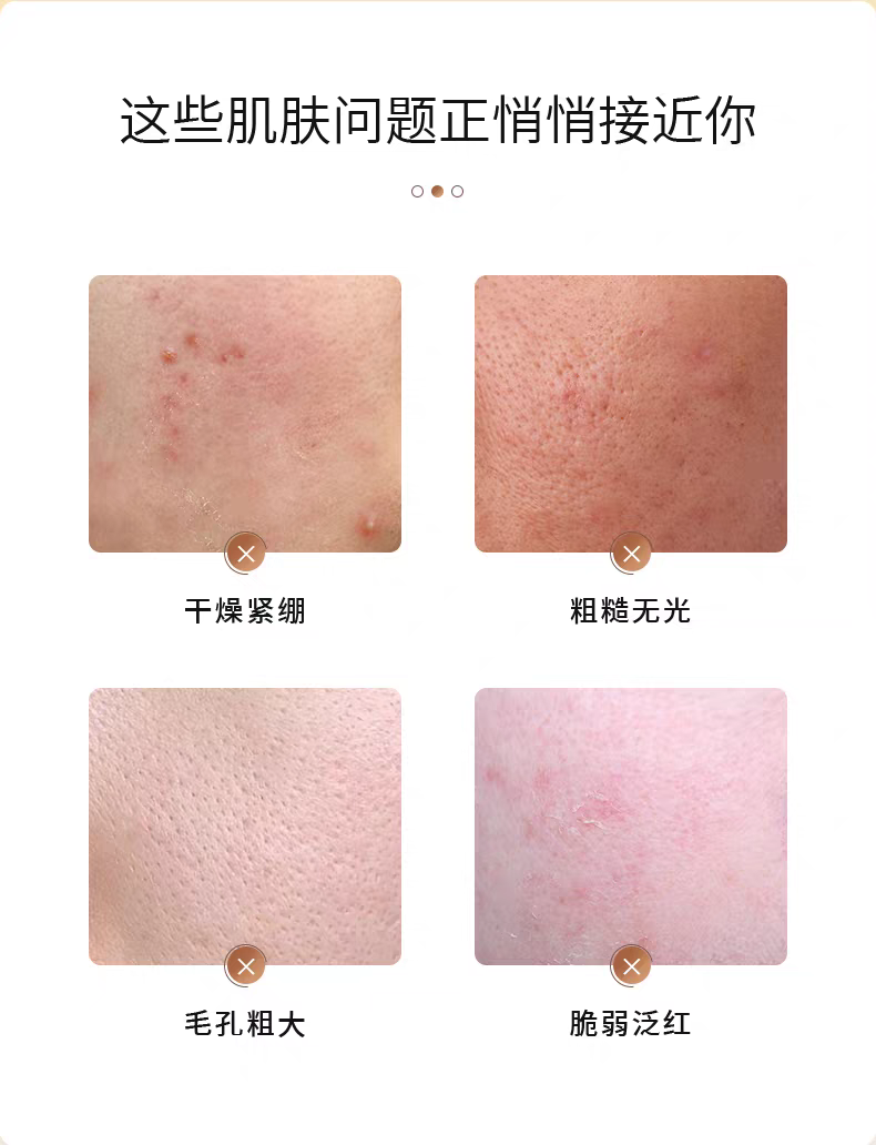 Fuerjia Light Bulb Mask, Fuerjia Astaxanthin Transglutamic Acid Repair Patch 5-piece set Hydrating, Moisturizing and Repairing Skin Mask, Official genuine product for sensitive skin detail image 2