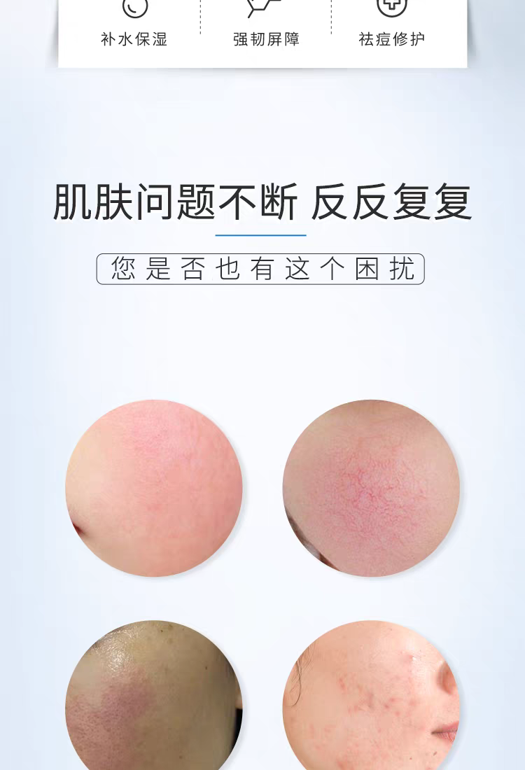 Fuerjia Sodium Hyaluronate Repair Patch 5-piece set Hydrating, Moisturizing, acne-removing and sensitive Skin Mask, non-irritating Fuerjia mask detail image 2