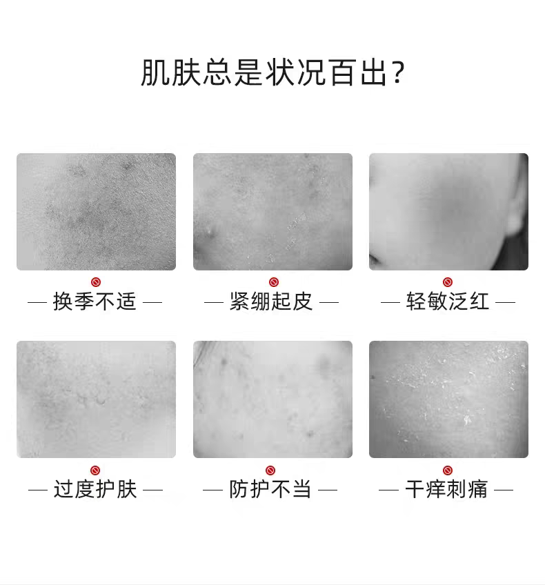 Minmin Fuerjia Centella asiatica Soothing Repair Patch Mask 5-piece set Hydrates, moisturizes, soothes the redness barrier of sensitive skin and repairs the sun exposure detail image 2
