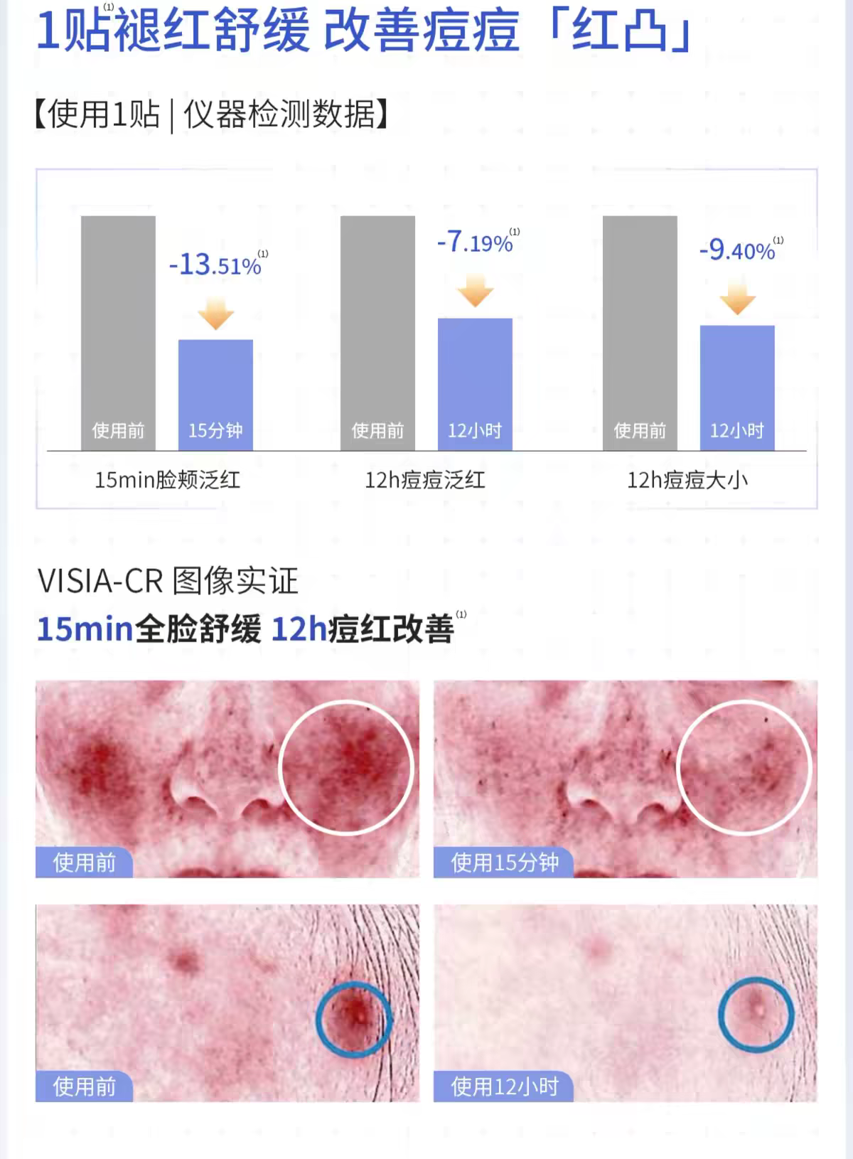 Fuerjia Acne-Clearing, Skin-Cleansing and Repairing Patch 2.0 Mask, 5 pieces per box. Official genuine salicylic acid detail image 5