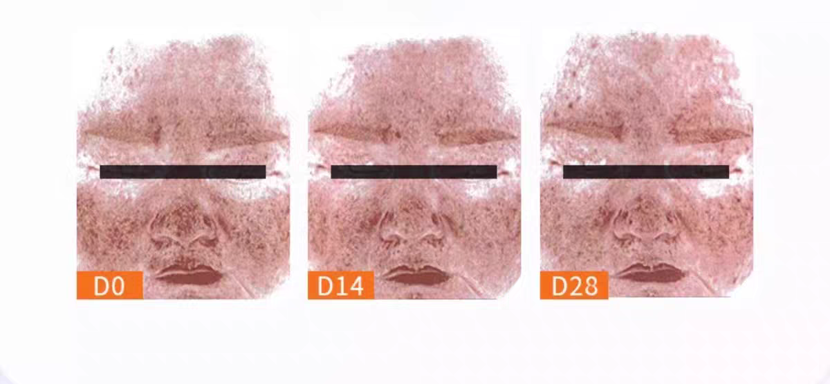 Fuerjia Blue Copper Peptide Anfu Patch Mask 5 pieces per box repairs, moisturizes, hydrates, sooths and hydrates sensitive skin detail image 6