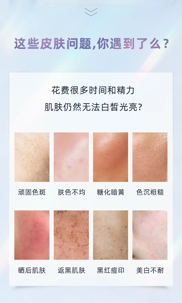 Fuerjia Niacinamide Whitening, Spot-removing and Repairing Mask: 5 pieces per box. Repairs and brightens skin tone, gently hydrates and moisturizes pigmentation, and improves dullness. Fuerjia Glow Mask detail image 2