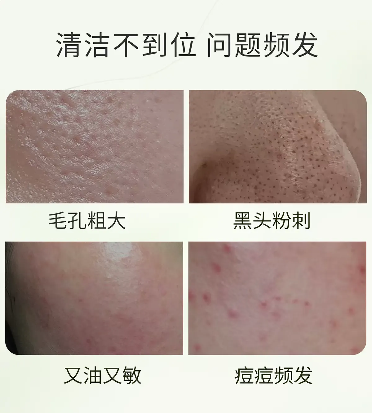 Xinlan Cryogenic Cleansing Mask, Taiwan Xinlan Duomekaya Cryogenic Cleansing Cleansing Mask, application-based Mud Mask for Hydrating, Acne Removal and Deep Pore Cleansing, 225g detail image 3