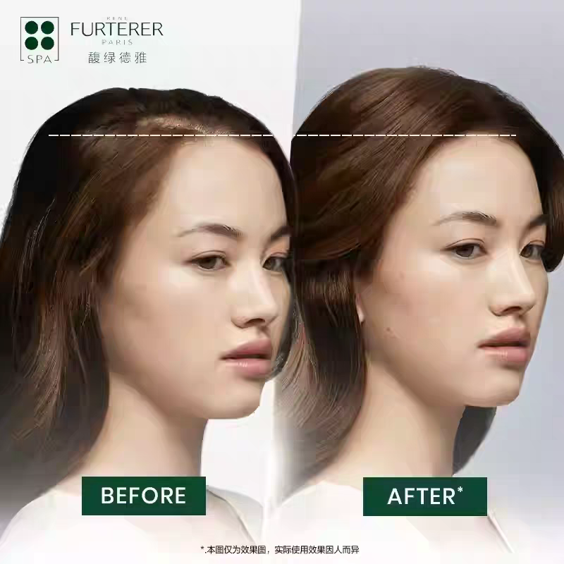 Fulu Deya 3rd Generation White Pearl Shampoo Anti-Hair Loss, Firming, Strong and Fluffy Shampoo, 500ml Application Scenario